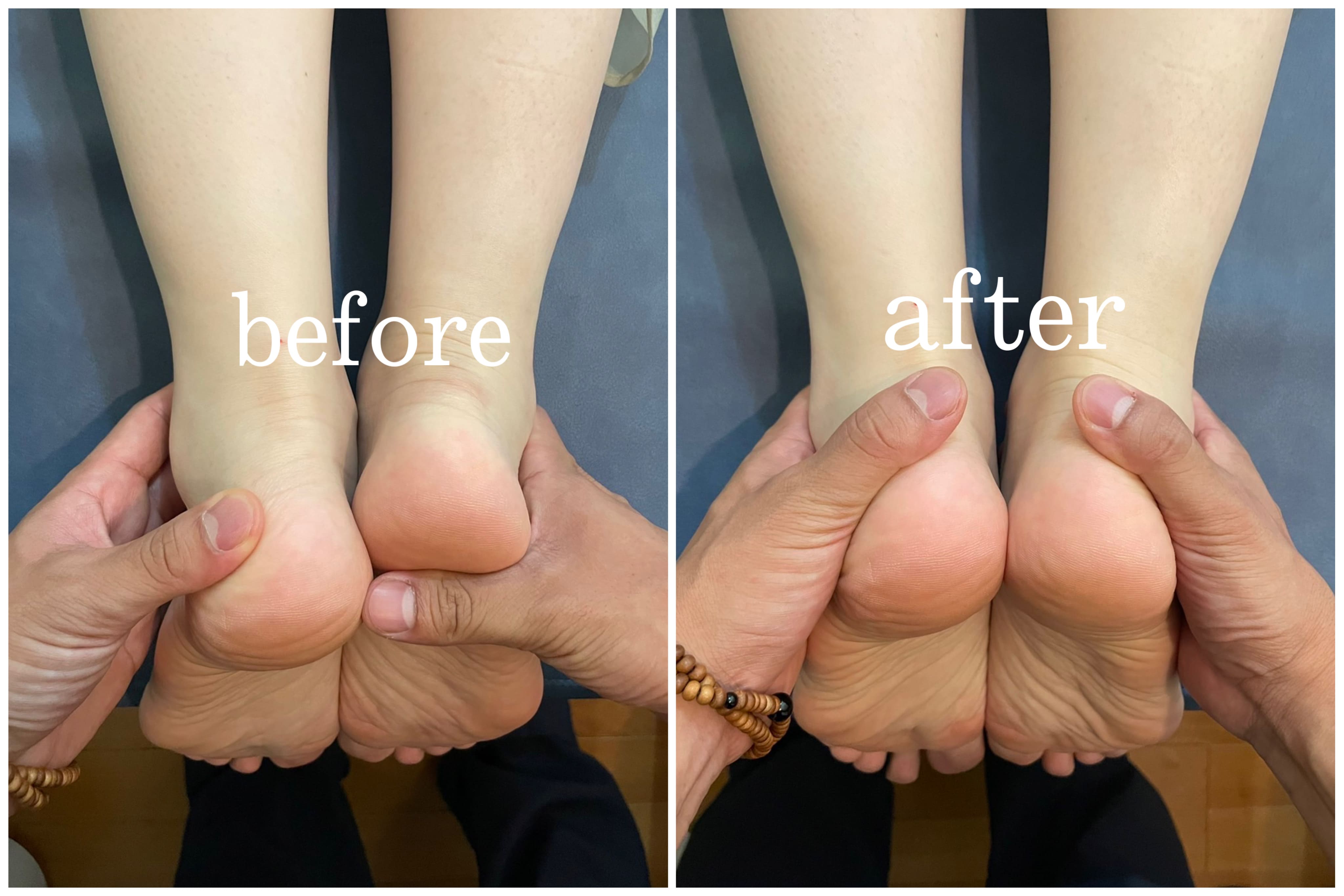 before_after3